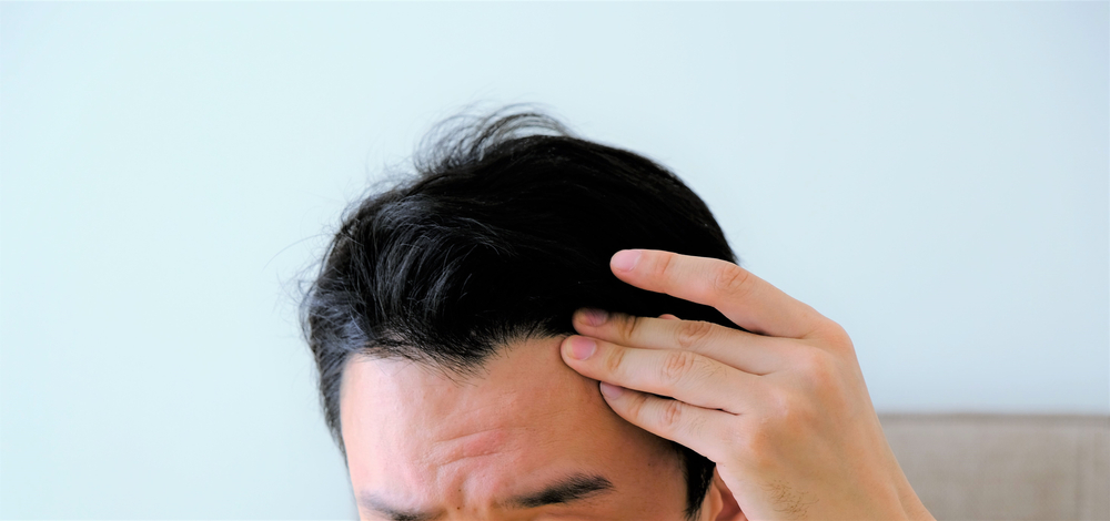 リアップ®(ミノキシジル)の初期脱毛は効果ありのサイン?副作用の一種?