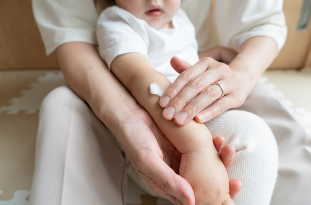 子どもの乾燥肌に使える市販薬(保湿剤)を紹介|クリームタイプ、ローションタイプなど