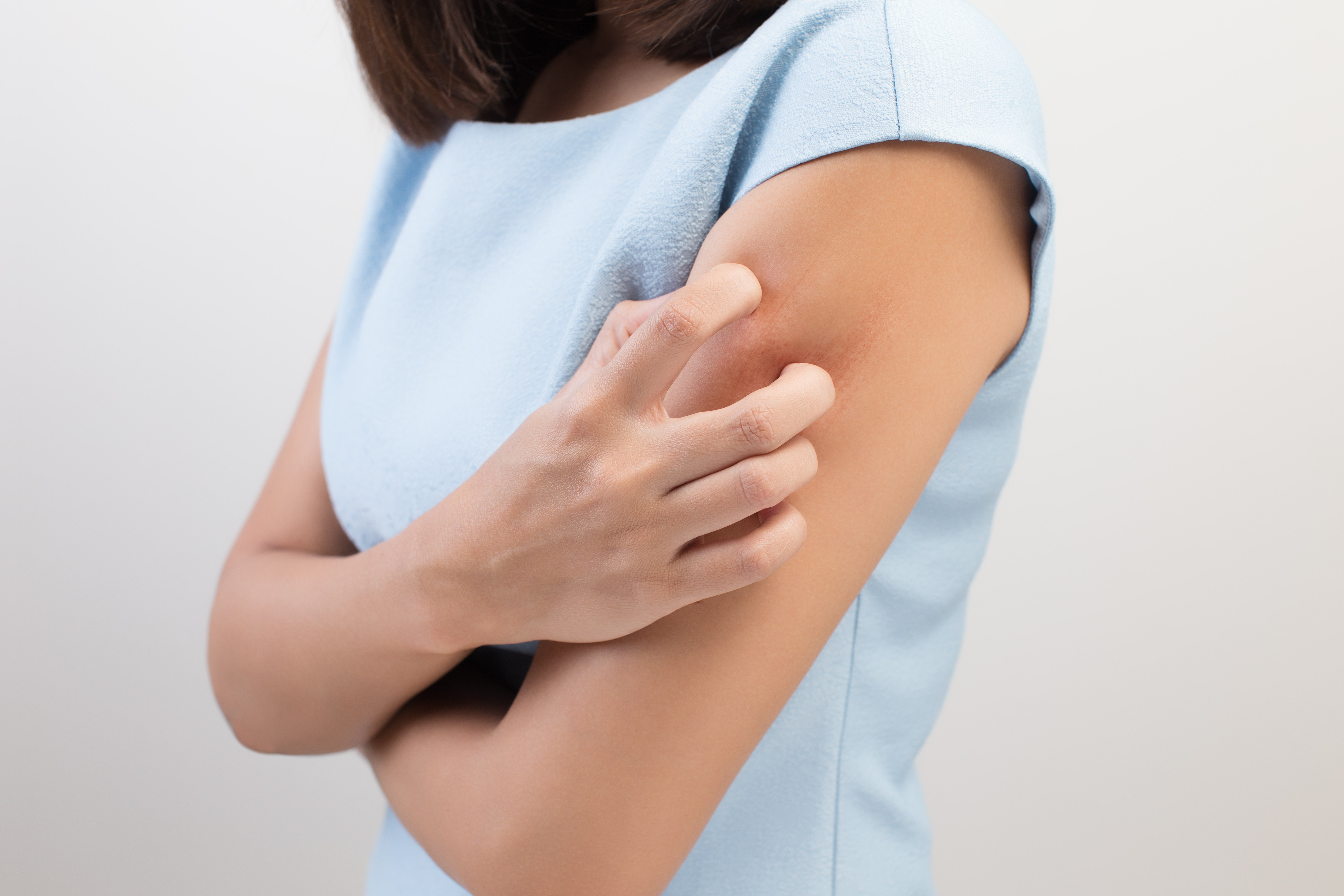 もう虫に刺されない！虫刺されの予防方法