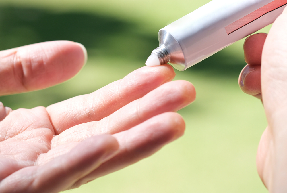 フロリード®Dクリーム（ミコナゾール硝酸塩）の代用となる市販薬はある？｜水虫薬・膣カンジダ再発治療薬