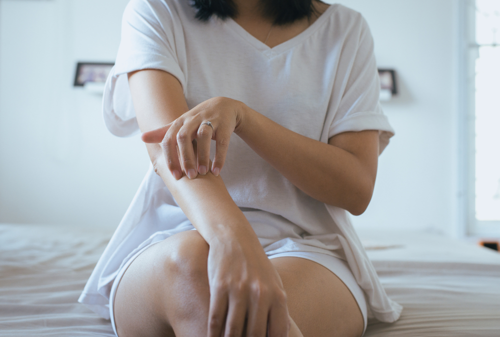 乾燥肌のかゆみ・湿疹に｜市販薬の使い分けについて解説【シミを残さないために】