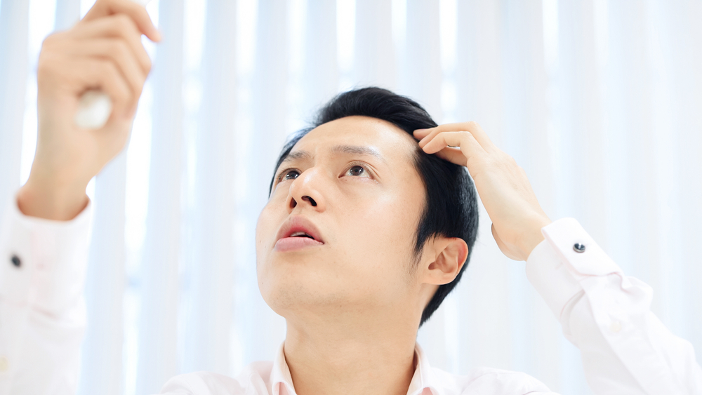 ミノキシジルの効果・効能|市販で購入できる外用薬を紹介