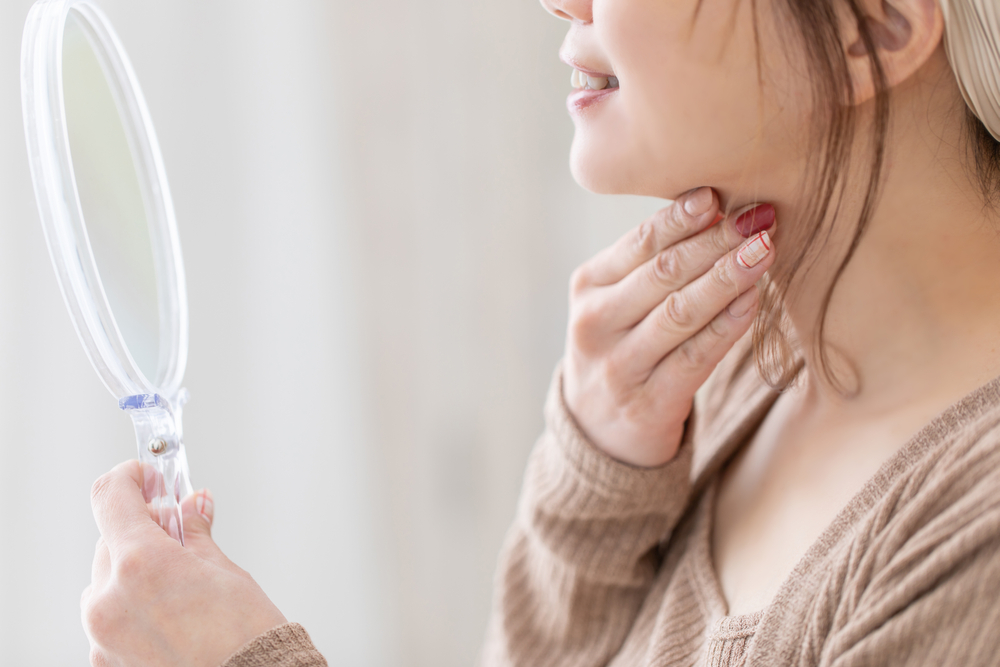 あごニキビに効く市販薬｜原因やおすすめの予防法も紹介