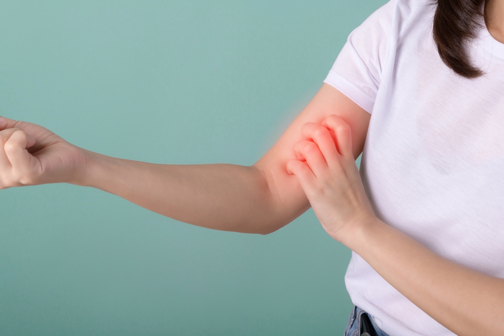 湿疹（皮膚炎）の原因と症状を徹底解説！市販薬での対処法も