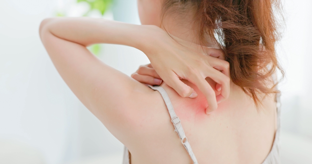 あせも・とびひ・汗かぶれ・湿疹の違いは？症状・見分け方を比較表で解説【受診の目安も】