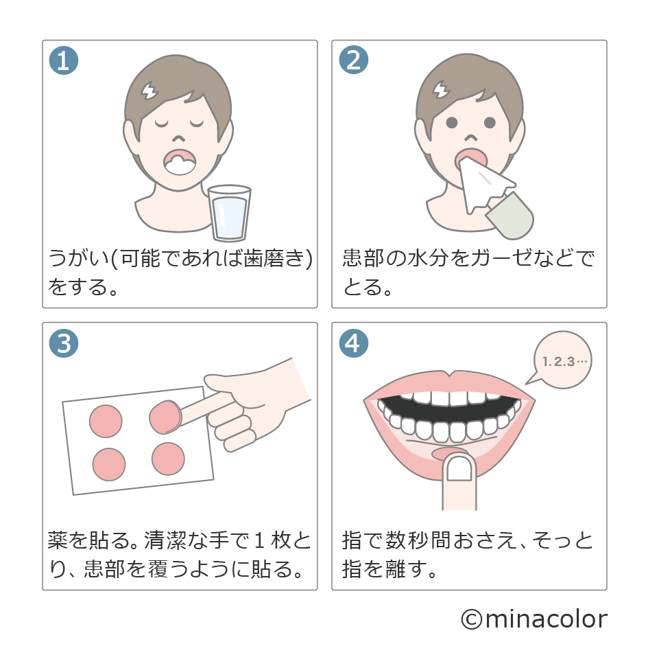 貼り薬(パッチ・貼付け錠)の使い方